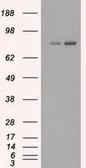 Anti-Mig-2 antibody [14A11] used in Western Blot (WB). GTX84506