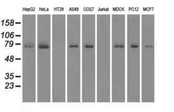 Anti-Mig-2 antibody [9E4] used in Western Blot (WB). GTX84507