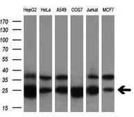 Anti-BDH2 antibody [4G4] used in Western Blot (WB). GTX84833