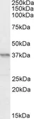 Anti-PAX4 antibody, Internal used in Western Blot (WB). GTX88129
