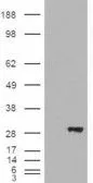 Anti-BDH2 (aa 60 to 71) antibody, Internal used in Western Blot (WB). GTX88892