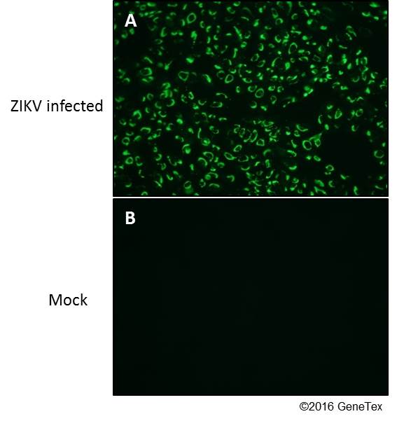 envelopeprotein,spikeprotein zika virus envelope protein抗体