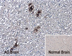 beta Amyloid (1-42) antibody – Conformation Specific_2 beta Amyloid (1-42) antibody – Conformation Specific_2