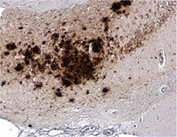 beta Amyloid (1-42) antibody – Conformation Specific_3