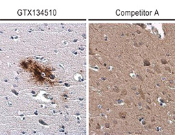 beta Amyloid (1-42) antibody – Conformation Specific_4 beta Amyloid (1-42) antibody – Conformation Specific_4