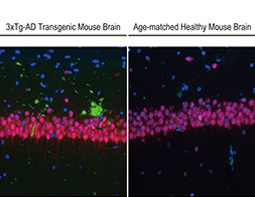 Beta amyloid (1-42) antibody – Conformation Specific antibody [GT622]_2