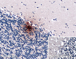 Beta amyloid (1-42) antibody – Conformation Specific antibody_4[GT622]