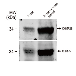 CHMP2B antibody (GTX118181) & CHMP5 antibody [N1C3] (GTX106692)
