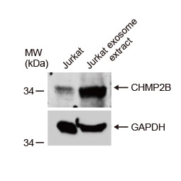 CHMP2B antibody (GTX118181)