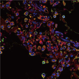 SARS-CoV / SARS-CoV-2 (COVID-19) Spike antibody [1A9] (GTX632604)