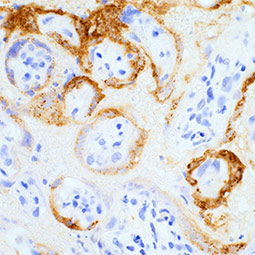 SARS-CoV / SARS-CoV-2 (COVID-19) Spike antibody [1A9] (GTX632604)