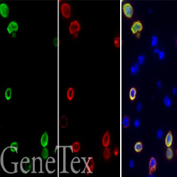 SARS-CoV-2 (COVID-19) Spike FFPE Cell Pellet Block (GTX435640)