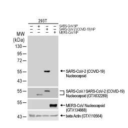 SARS-CoV-2 (COVID-19) Nucleocapsid antibody [HL344] (GTX635679)