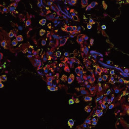 SARS-CoV / SARS-CoV-2 (COVID-19) Spike antibody [1A9] (GTX632604)