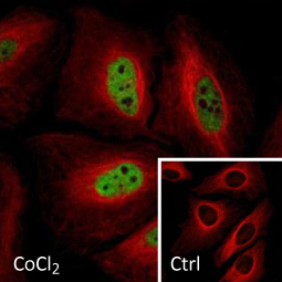 HIF1 alpha antibody (GTX127309)