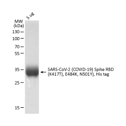 SARS-CoV-2 (COVID-19) Spike RBD (N501Y Mutant) protein, His tag (active)