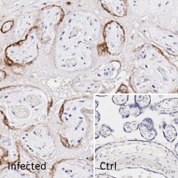 SARS-CoV / SARS-CoV-2 (COVID-19) spike antibody [1A9] (GTX632604)