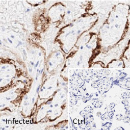 SARS-CoV-2 (COVID-19) nucleocapsid antibody [HL344]