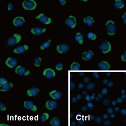 Dengue virus NS1 protein antibody (GTX124280)