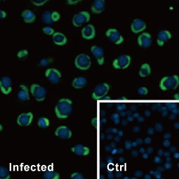 Dengue virus NS3 protein antibody (GTX124252)