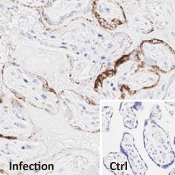 Spike RBD antibody [HL257] (GTX635692) 