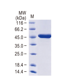 Nucleocapsid protein, B.1.1.529 / Omicron variant, His tag Nucleocapsid protein, B.1.1.529 / Omicron variant, His tag