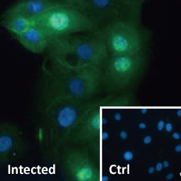 Zika virus NS5 protein antibody (GTX133312)