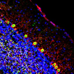 EN1 antibody (GTX134013)