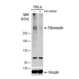 Fibronectin antibody [N1N2], N-term (GTX112794)