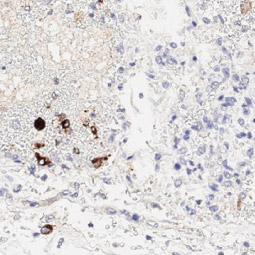 SARS-CoV / SARS-CoV-2 (COVID-19) spike antibody [1A9] (GTX632604)