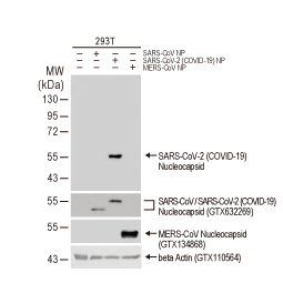SARS-CoV-2 (COVID-19) nucleocapsid antibody [HL344] (GTX635679) 