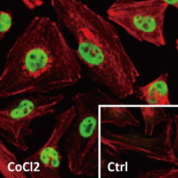 HIF1 alpha antibody (GTX127309)