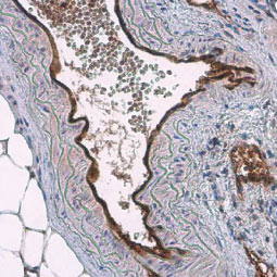 CD31 antibody (GTX130274) 