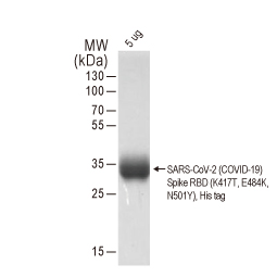 SARS-CoV-2 (COVID-19) Spike RBD (K417T, E484K, N501Y Mutant) protein, His tag (GTX136043-pro)