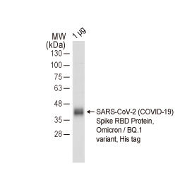 SARS-CoV-2 (COVID-19) Spike RBD Protein, Omicron / BQ.1 variant, His tag (GTX137879-pro)