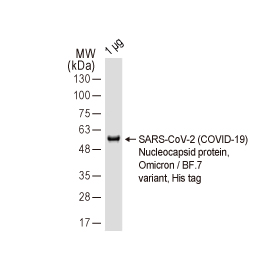 SARS-CoV-2 (COVID-19) Nucleocapsid protein, Omicron / BF.7 variant, His tag (GTX137882-pro)