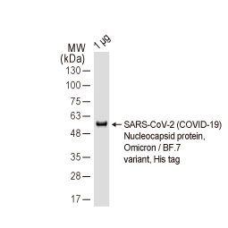 SARS-CoV-2 (COVID-19) Nucleocapsid protein, Omicron / BF.7 variant, His tag (GTX137882-pro) SARS-CoV-2 (COVID-19) Nucleocapsid protein, Omicron / BF.7 variant, His tag (GTX137882-pro)