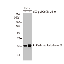 Carbonic Anhydrase IX antibody [HL1410] (GTX636876)