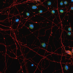 OLIG2 antibody [HL1072] (GTX636104)