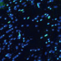 OLIG2 antibody [HL1072] (GTX636104)