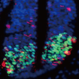 OLIG2 antibody [HL1072] (GTX636104)