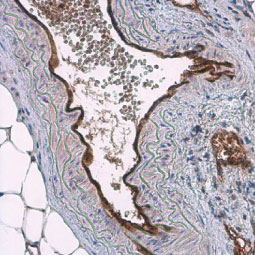 CD31 antibody (GTX130274)