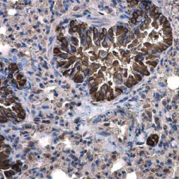 Calpain 1 antibody [N3C2], Internal (GTX102340)