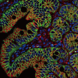 beta Catenin antibody [N1N2-2], N-term (GTX101435)