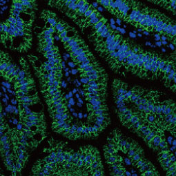 alpha Catenin antibody [N1N3] (GTX111168)