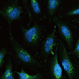 ROBO1 antibody 
(GTX114103) 