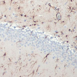 GFAP antibody [HL1307] (GTX636725)