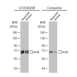 AChE antibody [HL1102] (GTX636298)