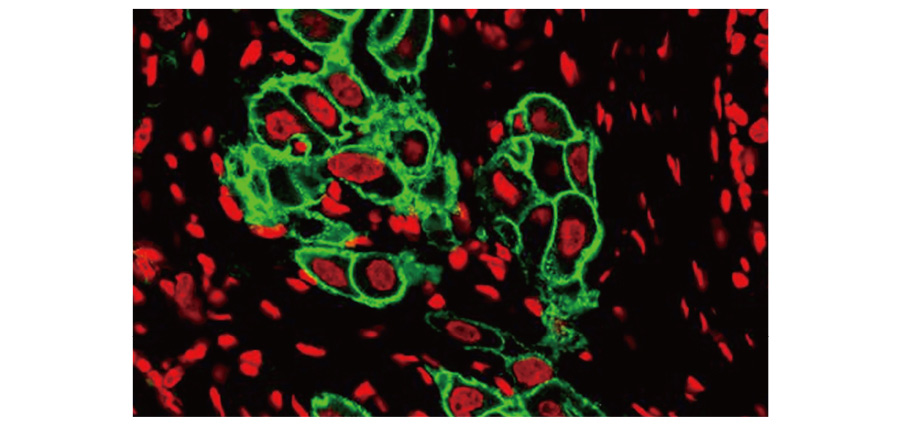 Her2 / ErbB2 antibody