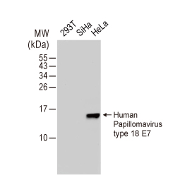 Human Papilloma Virus type 18 E7 antibody [GT881] (GTX634337)